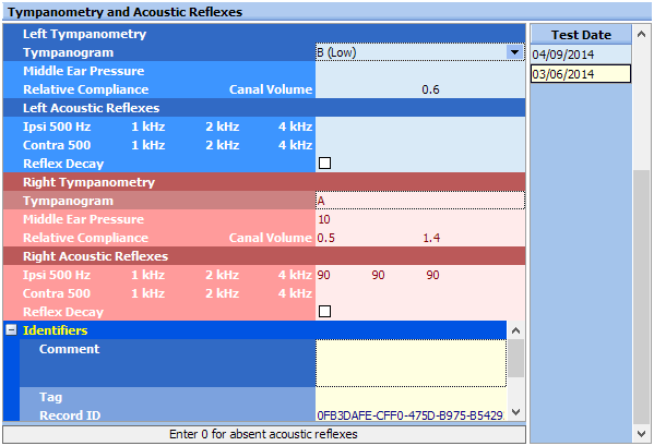 Impedance